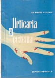Dr. Pavel Vulcan - Urticaria si eczema