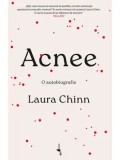 Acnee. O autobiografie/Laura Chinn
