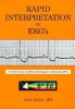 Rapid Interpretation of EKG&#039;s: Dr. Dubin&#039;s Classic, Simplified Methodology for Understanding EKG&#039;s