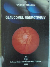 GLAUCOMUL NORMOTENSIV-CARMEN MOCANU foto