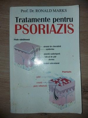 Tratamente pentru psoriazis- Ronald Marks foto