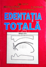 Edentatia totala. Aspecte clinice. Tratament foto