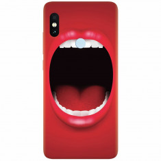 Husa silicon pentru Xiaomi Mi A2 Lite, Big Mouth