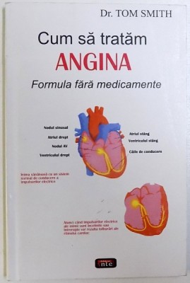 CUM SA TRATAM ANGINA - FORMULA FARA MEDICAMENTE de TOM SMITH , 2007 foto