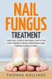 Nail Fungus Treatment: Cure Nail Fungus Naturally with This Fast Toenail Fungus Treatment and Toenail Fungus Cures