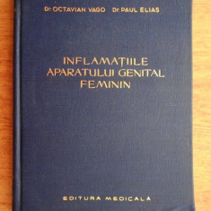 Octavian Vago, Paul Elias - Inflamatiile aparatului genital feminin