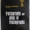 FRACTOGRAPHY AND ATLAS OF FRACTOGRAPH , METALS HANDBOOK VOL. 9 , 1974