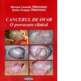 Cancerul de ovar. O provocare clinica - Mihaela Camelia Tirnovanu, Stefan Dragos Tirnovanu