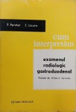 Cum interpretam examenul radiologic gastroduodenal - P. Porcher, C. Lacuire