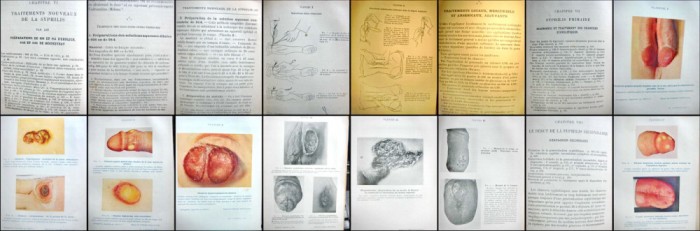5770-I-H.GOUGEROT- sau-Paris 1914. Medicina veche in FRANCEZA.