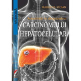 Actualitati in diagnosticul carcinomului hepatocelular - Marilena Stoian