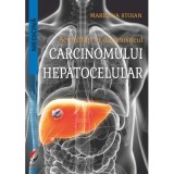 Actualitati in diagnosticul carcinomului hepatocelular - Marilena Stoian