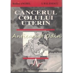 Cancerul Colului Uterin - Rodica Anghel, I. Balanescu