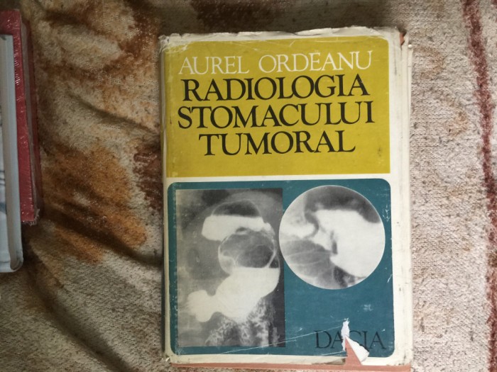 h5b AUREL ORDEANU - RADIOLOGIA STOMACULUI TUMORAL
