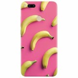 Husa silicon pentru Xiaomi Mi A1, Banana