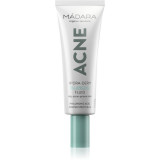 M&Aacute;DARA Acne fluid hidratant faciale 40 ml