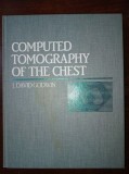 Computed Tomography of the Chest- J.David Godwin