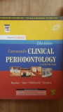 Carranza&#039;s Clinical periodontology for South Asia- Newman, Takei, Klokkevold