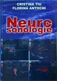 Cristina Tiu, Florina Antochi - Neurosonologie