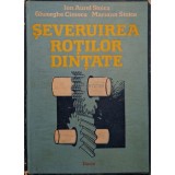 Ion Aurel Stoica - Severuirea rotilor dintate (Editia: 1987)