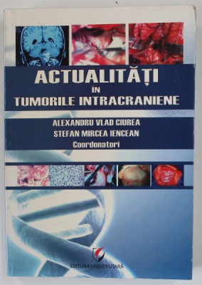ACTUALITATI IN TUMORILE INTRACRANIENE , coordonatori ALEXANDRU VLAD CIUREA si STEFAN MIRCEA IENCEAN , 2011 foto