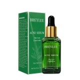 Ser anti-acnee Breylee Acne Treatment Serum, 17 ml
