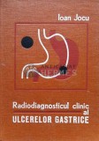 Cumpara ieftin Radiodiagnosticul clinic al ulcerelor gastrice - 1976 - Ioan Jocu (W105)
