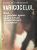 VARICOCELUL, BOALA CU POTENTIAL AGRESIV ASUPRA FUNCTIEI DE REPRODUCERE A BARBATULUI-IACOB MOLDOVAN-233219
