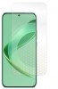 Folie pentru Huawei Nova 11 SE, Ultra-Rezistentă, Claritate Cristalină, Aplicare Ușoară