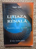 Cezar Vlad - Litiaza renala