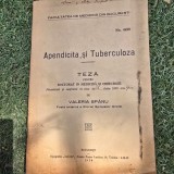 Apendicita si Tuberculoza. Teza de doctorat - Valeia Spinu