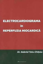 electrocardiograma in reperfuzia miocardica foto