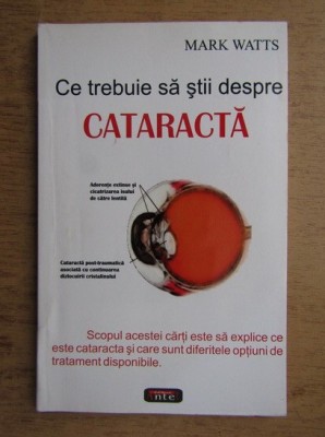 Mark Watts - Ce trebuie sa stii despre cataracta foto