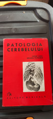 Patologia Cerebelului - Cezar Ionel, Arcadiu Petrescu STARE FOARTE BUNA foto