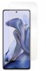 Folie pentru Xiaomi Redmi Note 11T, Ultra-Rezistentă, Claritate Cristalină, Aplicare Ușoară