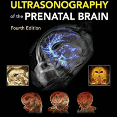 Ultrasonography of the Prenatal Brain, Fourth Edition