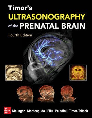 Ultrasonography of the Prenatal Brain, Fourth Edition foto