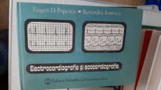 Electrocardiografie și ecocardiografie - Eugen D. Popescu, Ruxandra Ionescu foto