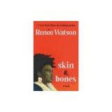 Skin &amp; Bones