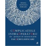 Complicatiile intraoperatorii ale operatiei de cataracta prin facoemulsificare - Dr. Ozana Moraru