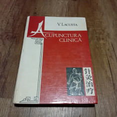 ACUPUNCTURA CLINICA - V. LACUSTA , 1996 foto