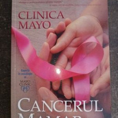 Clinica Mayo Cancerul mamar