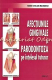 Afectiunile Gingivale Si Parodontza Pe Intelesul Tuturor - Nouri Davijani Mahnou