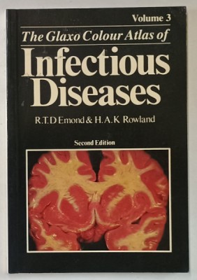 THE GLAXO COLOUR ATLAS OF INFECTIOUS DISEASES , VOLUME 3 by R.T.D. EMOND and H.A.K. ROWLAND , 1987 foto