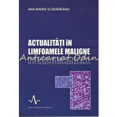 Actualitati In Limfoamele Maligne Nonhodgkiniene - Ana-Maria Vladareanu