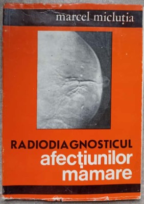 RADIODIAGNOSTICUL AFECTIUNILOR MAMARE-MARCEL MICLUTIA-238009 foto