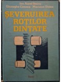Ioan Aurel Stoica - Șeveruirea roților dințate