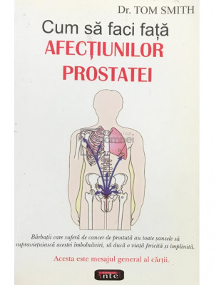 Tom Smith - Cum să faci față afecțiunilor prostatei (editia 2007) foto