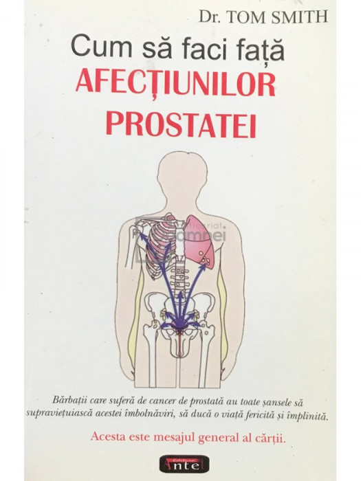 Tom Smith - Cum să faci față afecțiunilor prostatei (editia 2007)