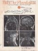 American Family Physician, February 1987